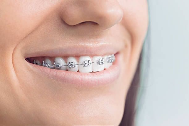 Full Mouth Reconstruction in Brookside Village, TX